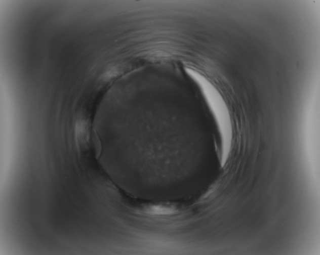 X0000086260232200704122016
