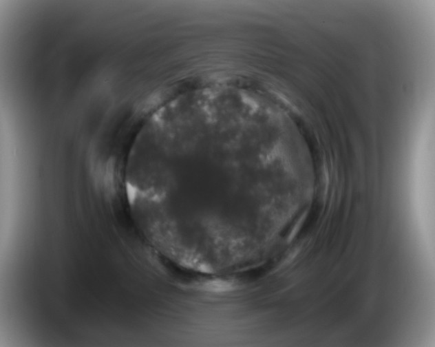 X0000086260236200704122016
