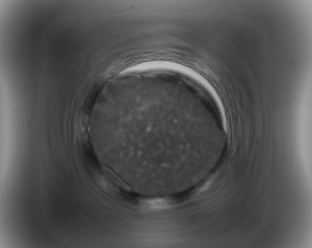 X0000086260237200704122016