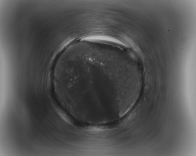 X0000086260250200704122015