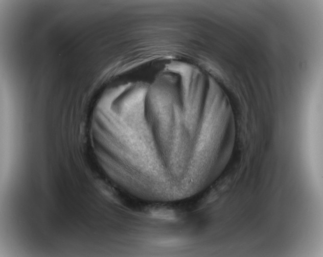 X0000086260258200704122015