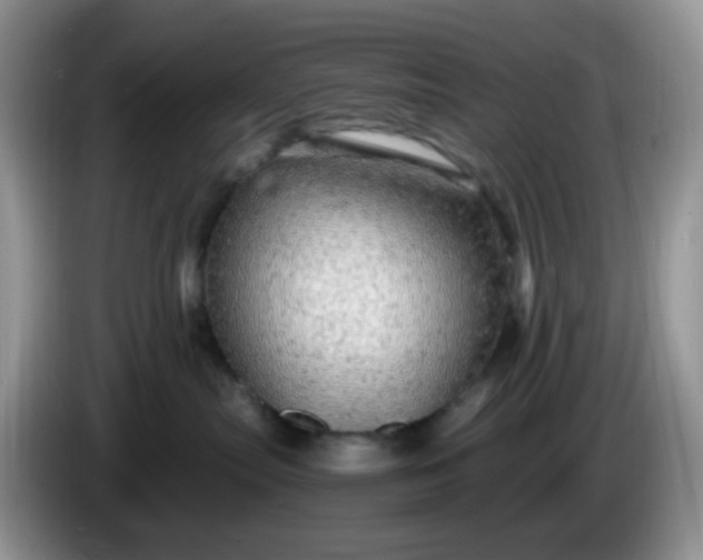 X0000086260287200704122016