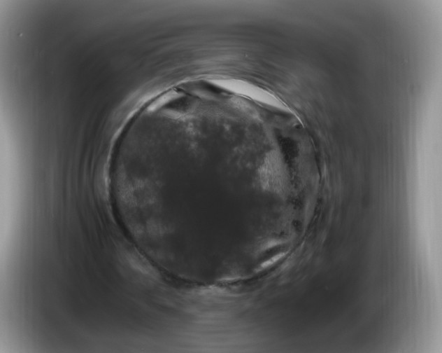 X0000086260290200704122015