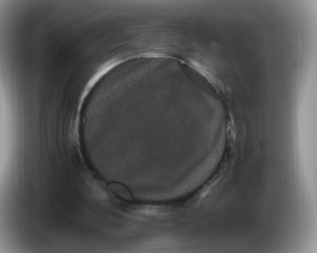 X0000086260292200704122015