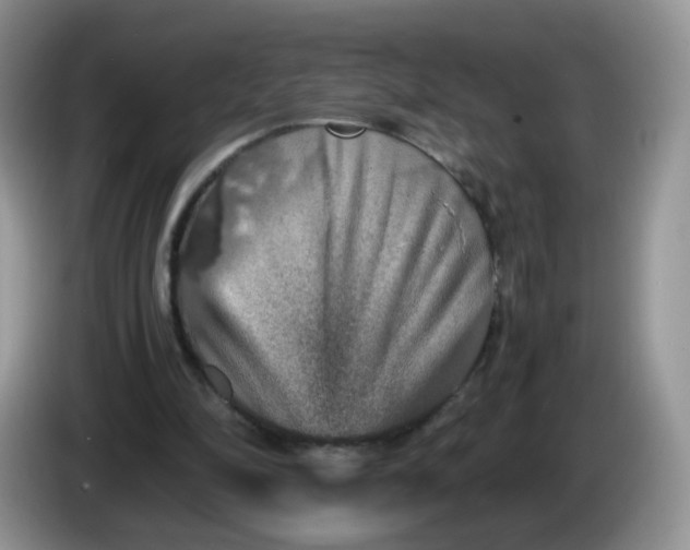 X0000086260294200704122015