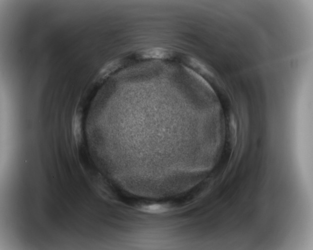 X0000086260312200704122015