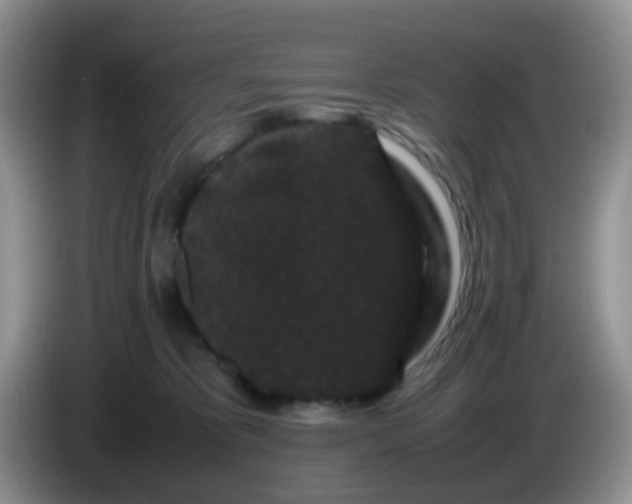 X0000086260325200704122015
