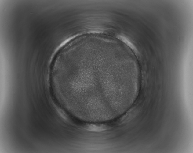 X0000086260346200704122014