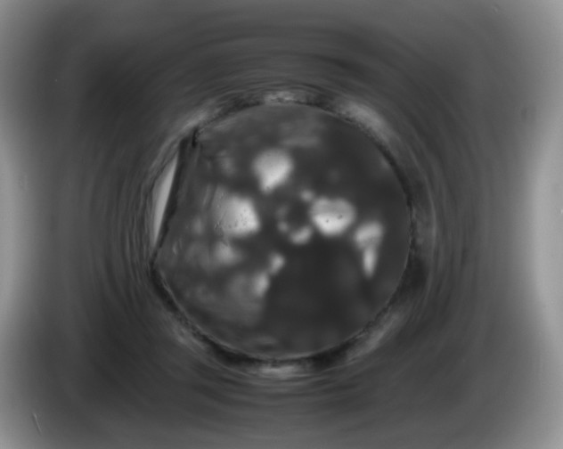 X0000086260357200704122014