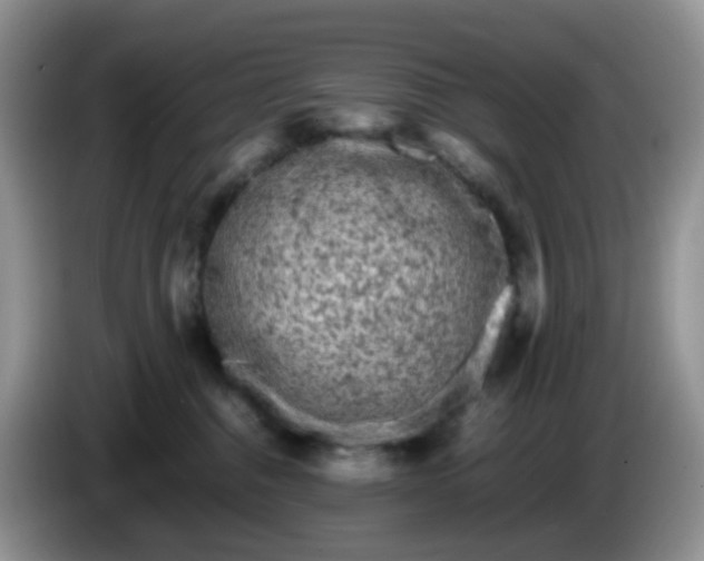 X0000086260376200704122014