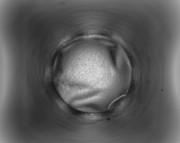 X0000086260378200704122014