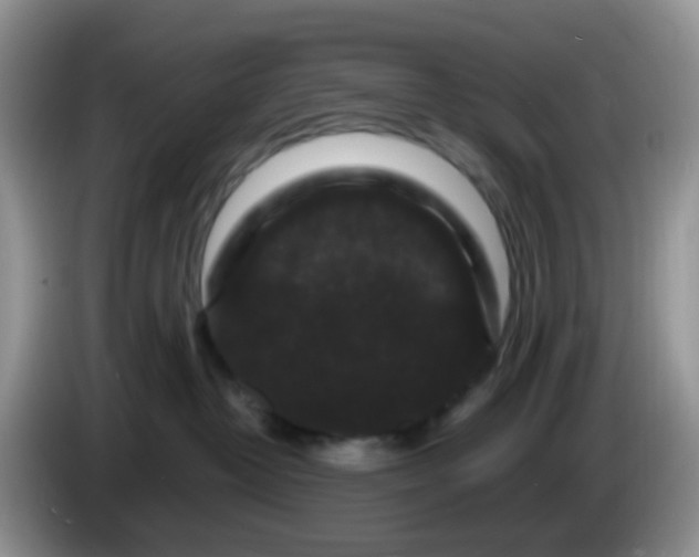 X0000086260382200704122014