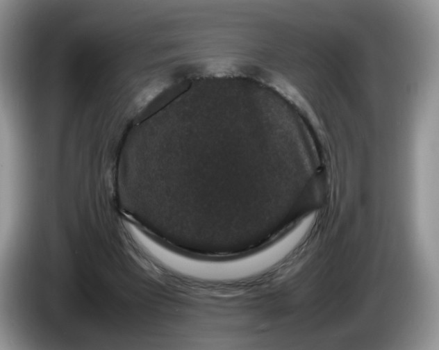 X0000086260393200704122014