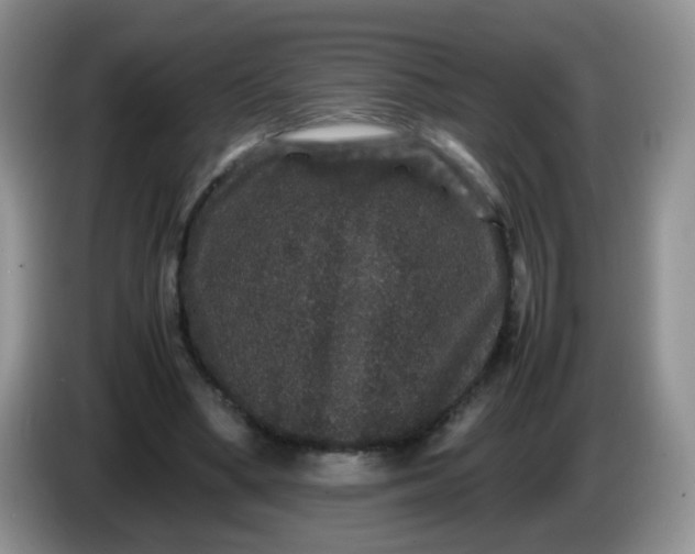 X0000086260394200704122014