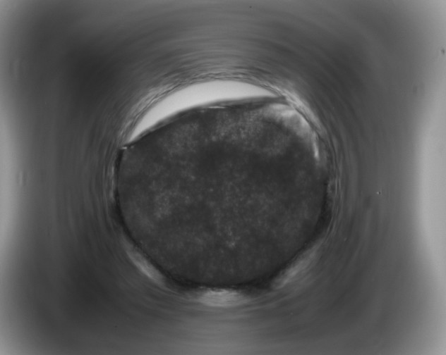 X0000086260397200704122014