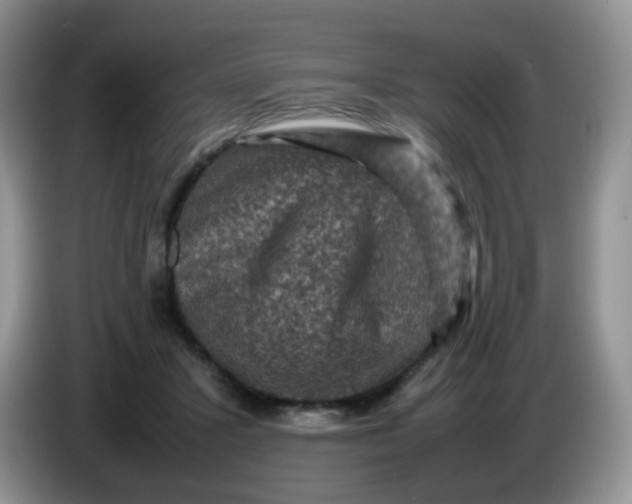 X0000086260407200704122014
