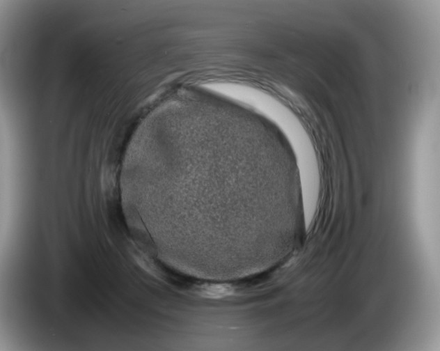 X0000086260409200704122014