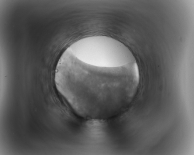 X0000086260672200704122011