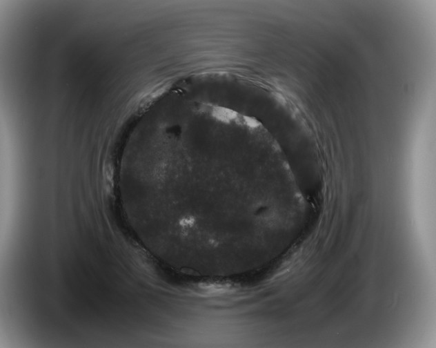 X0000086260693200704122010