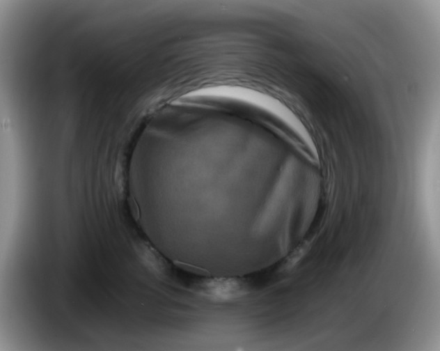 X0000086260762200704122010