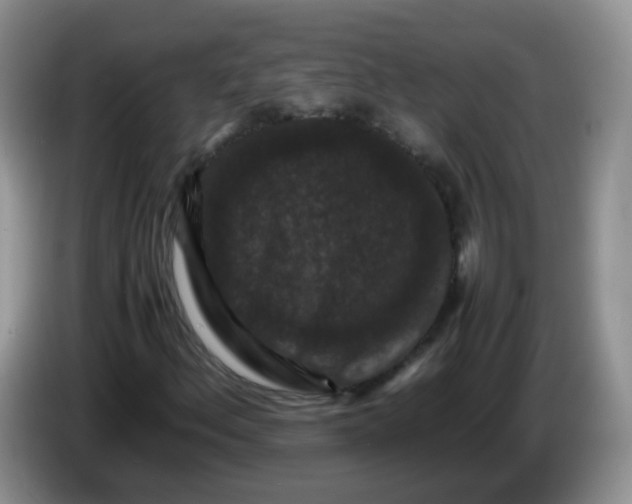 X0000086261156200704122005