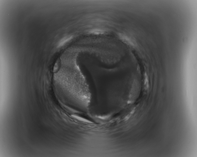 X0000086261158200704122005
