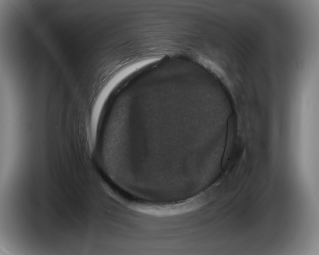 X0000086260017200704191913