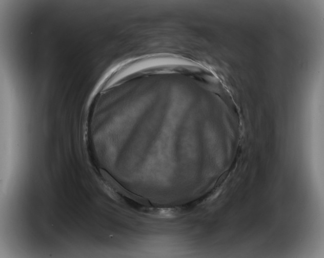 X0000086260056200704191912