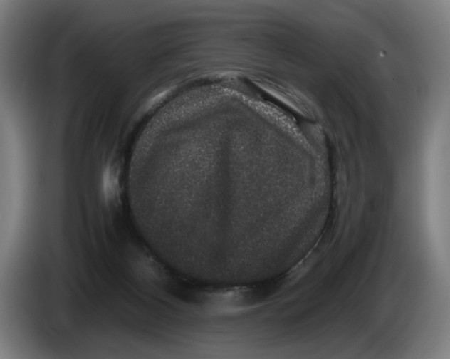 X0000086260116200704191912