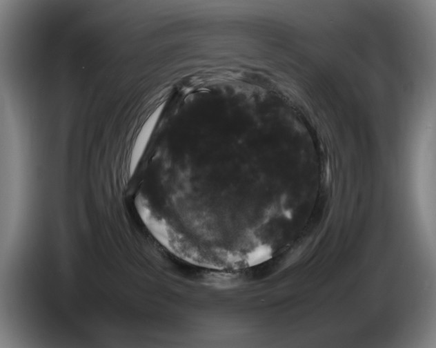 X0000086260139200704191911