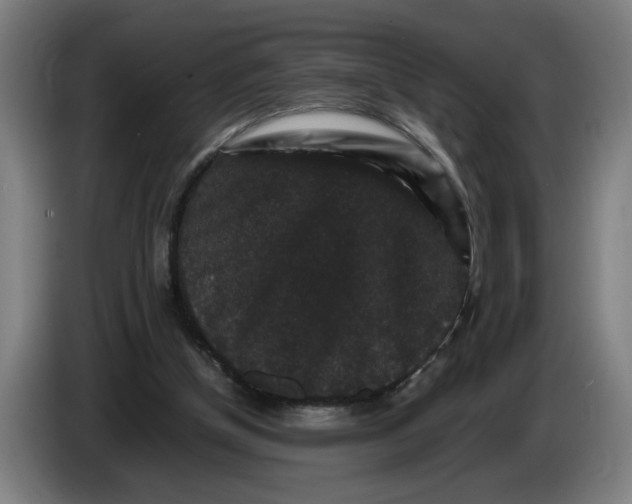 X0000086260154200704191911