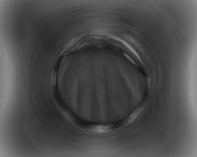 X0000086260168200704191911