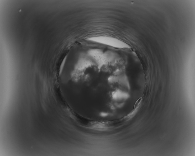 X0000086260182200704191911
