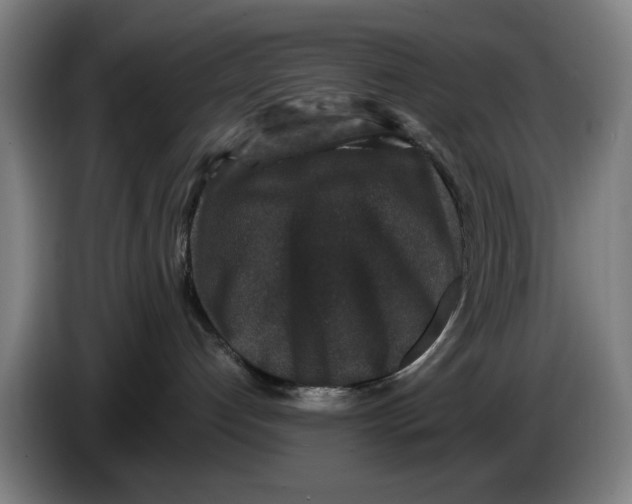 X0000086260192200704191911