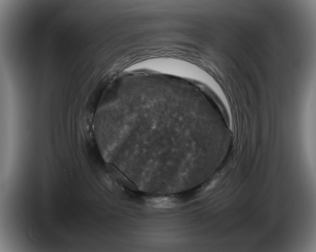 X0000086260237200704191910