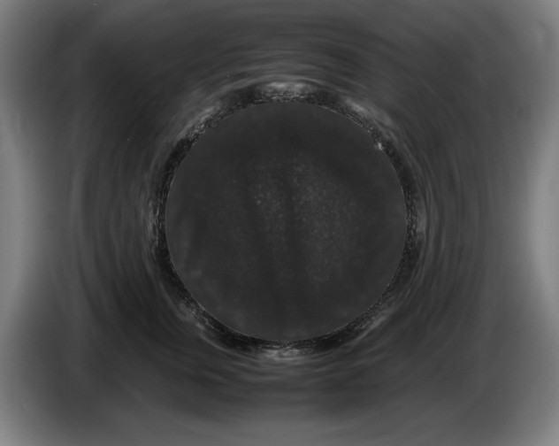 X0000086260759200704191903