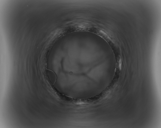 X0000086261009200704191859