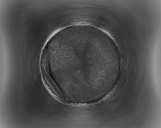 X0000086261038200704191859