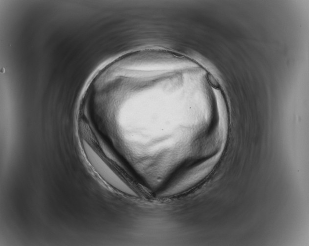 X0000086261104200704191858