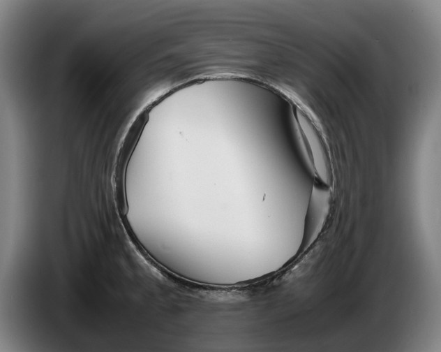 X0000086261189200704191857