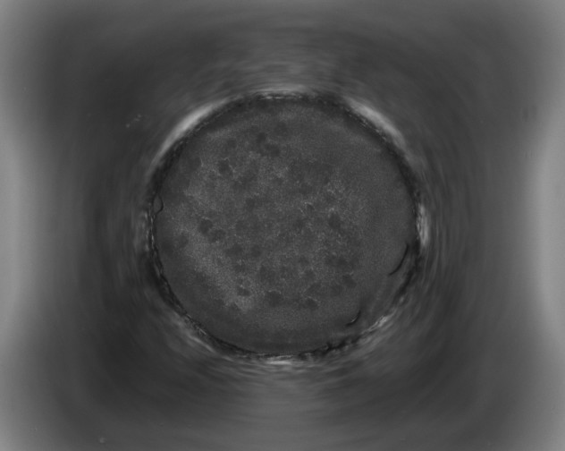 X0000086261208200704191856