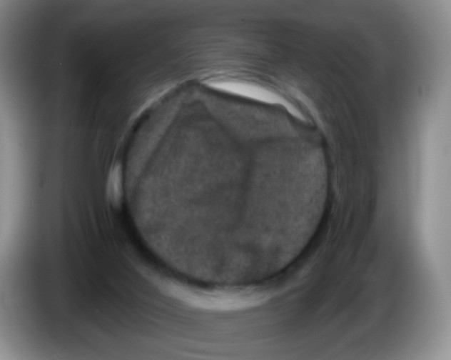 X0000086260020200704262005