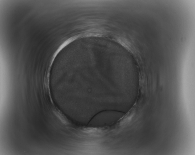 X0000086260100200704262004