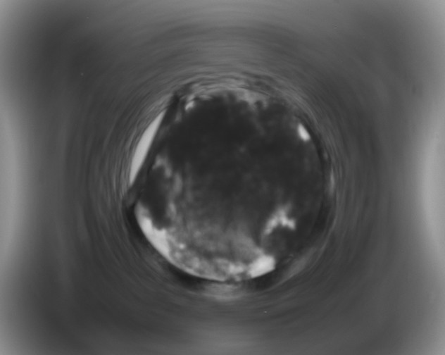 X0000086260139200704262003