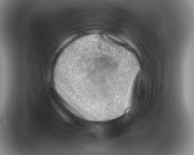 X0000086260159200704262003