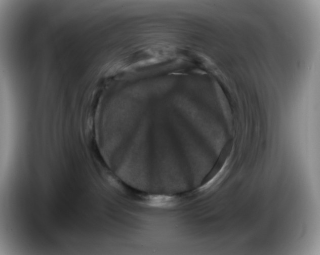 X0000086260192200704262003