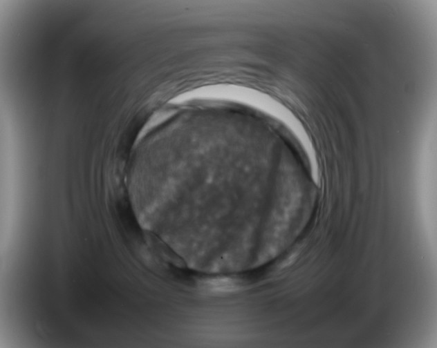 X0000086260237200704262002