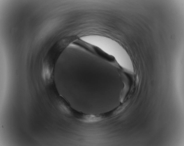X0000086260239200704262002