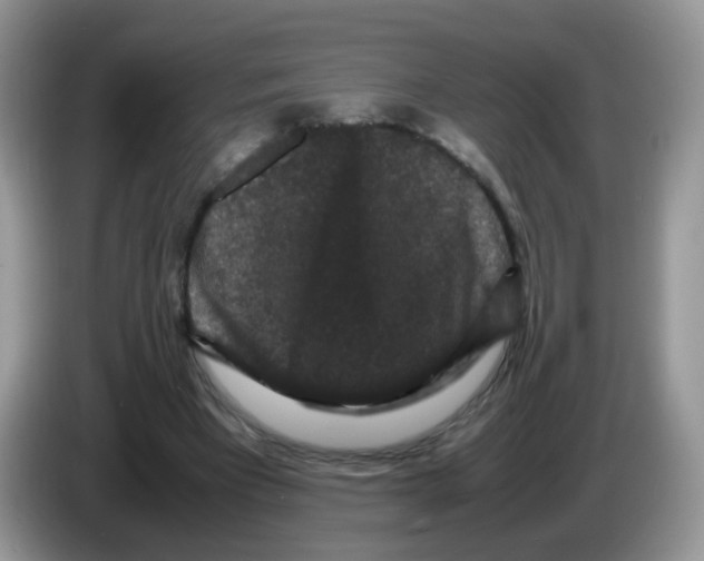 X0000086260393200704262000