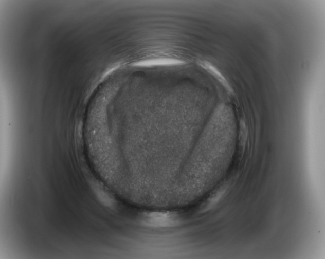 X0000086260394200704262000